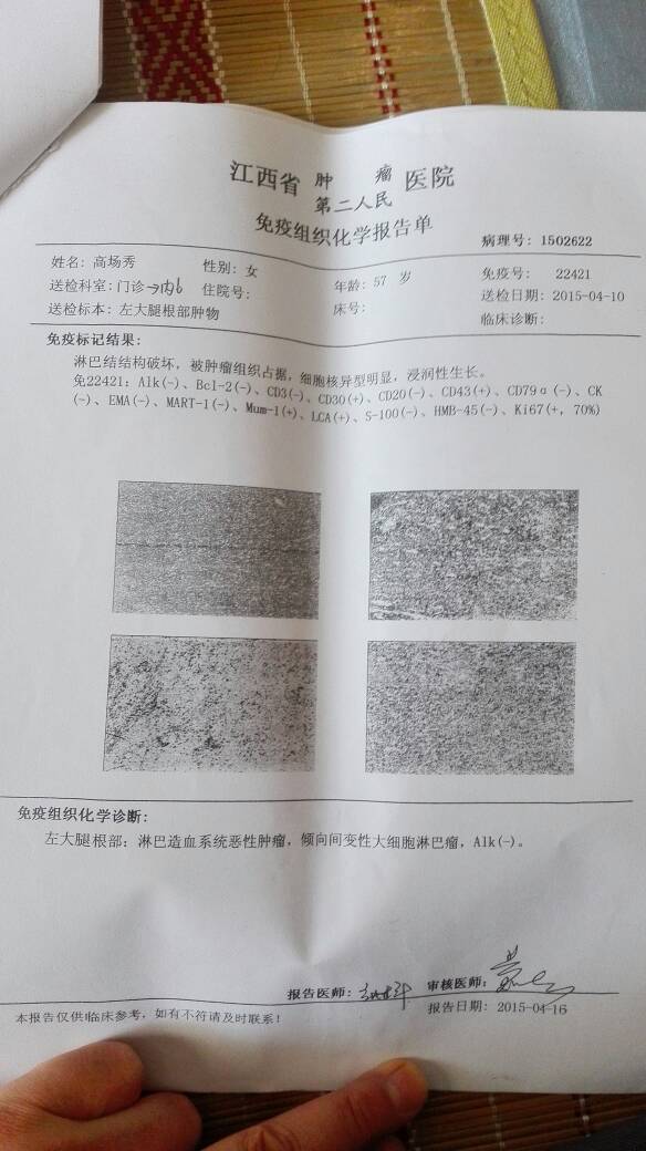 093358kpp71a7uruqf1zv7.jpg