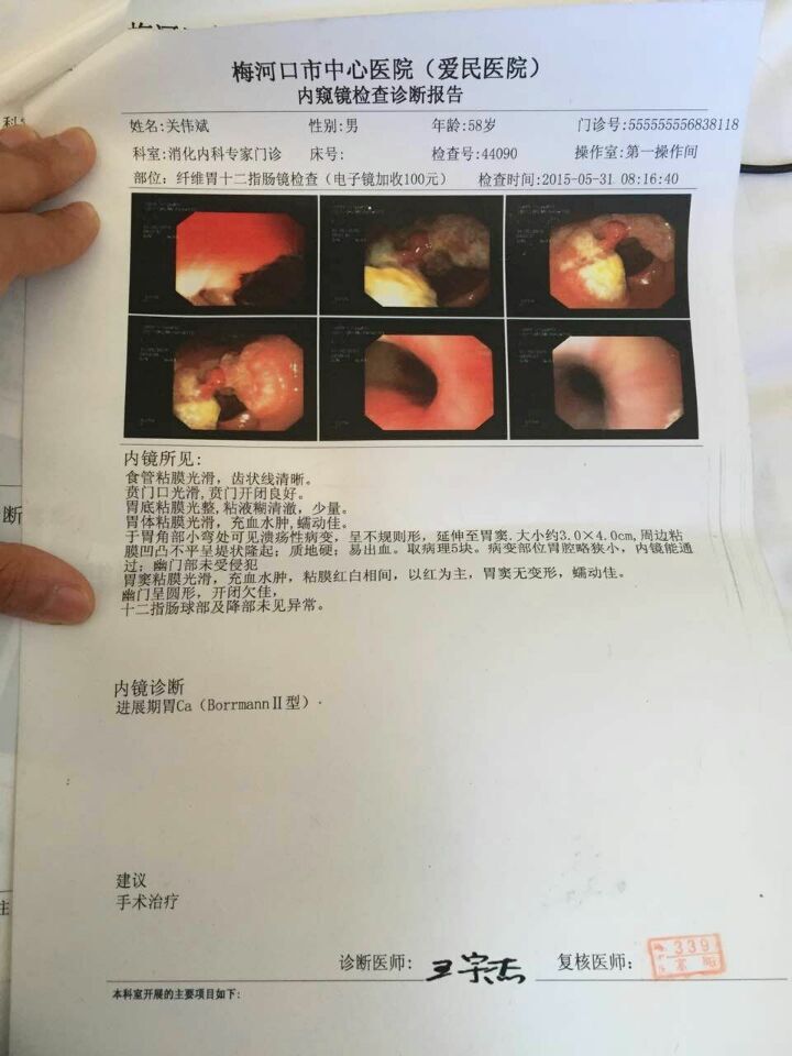 5-31梅河医院胃镜.jpg