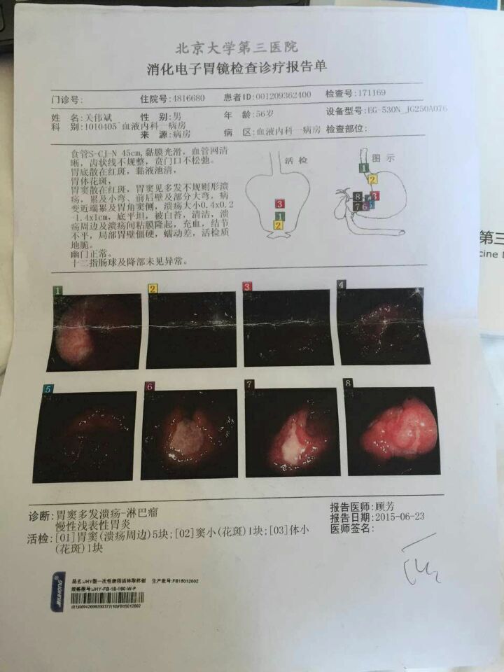 6-23 北大三院胃镜.jpg