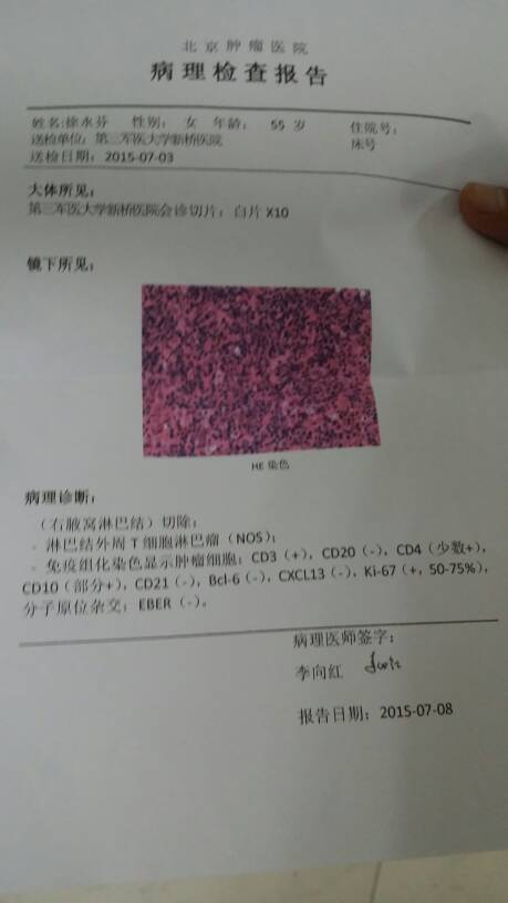 150800btdelorntolshihk.jpg