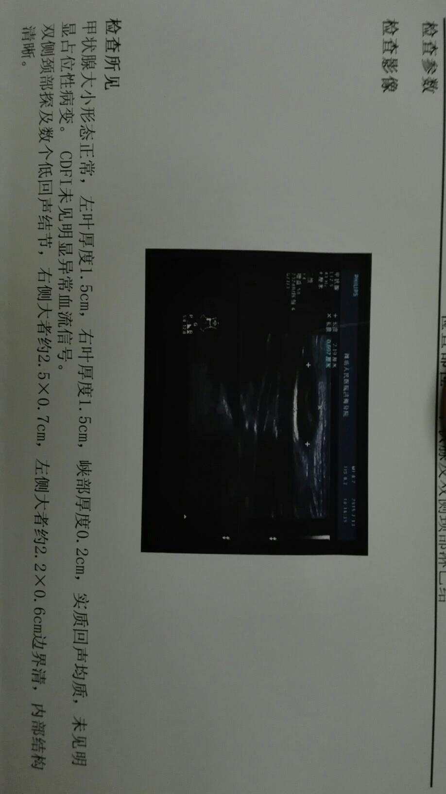 151111h4zkv2l3bqquuahk.jpg