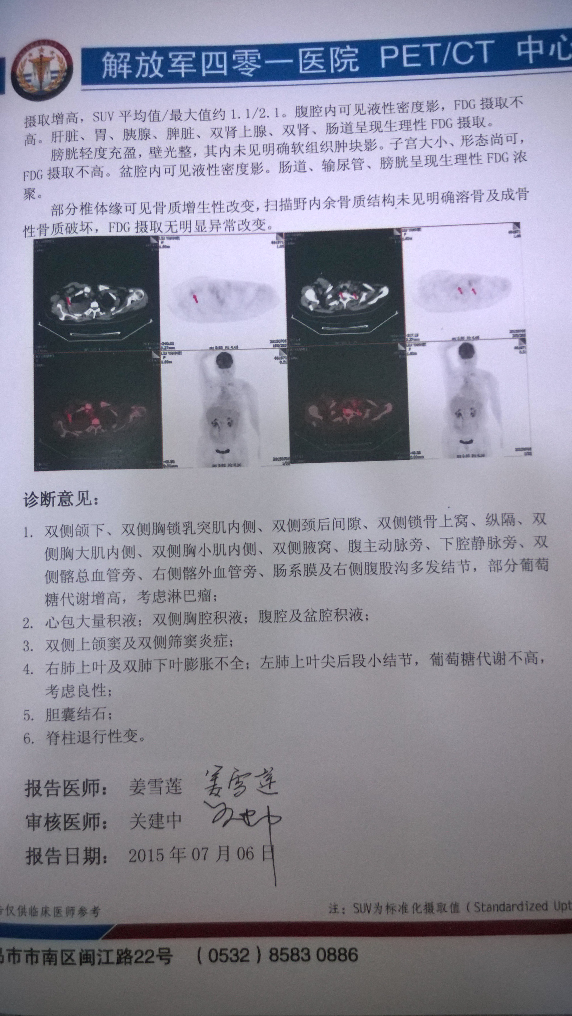 pect-ct报告2