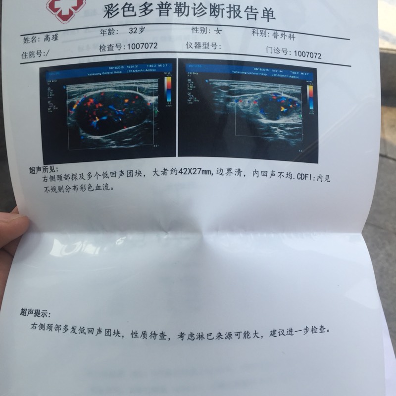 110336e8ulwwnptgtbsppl.jpg