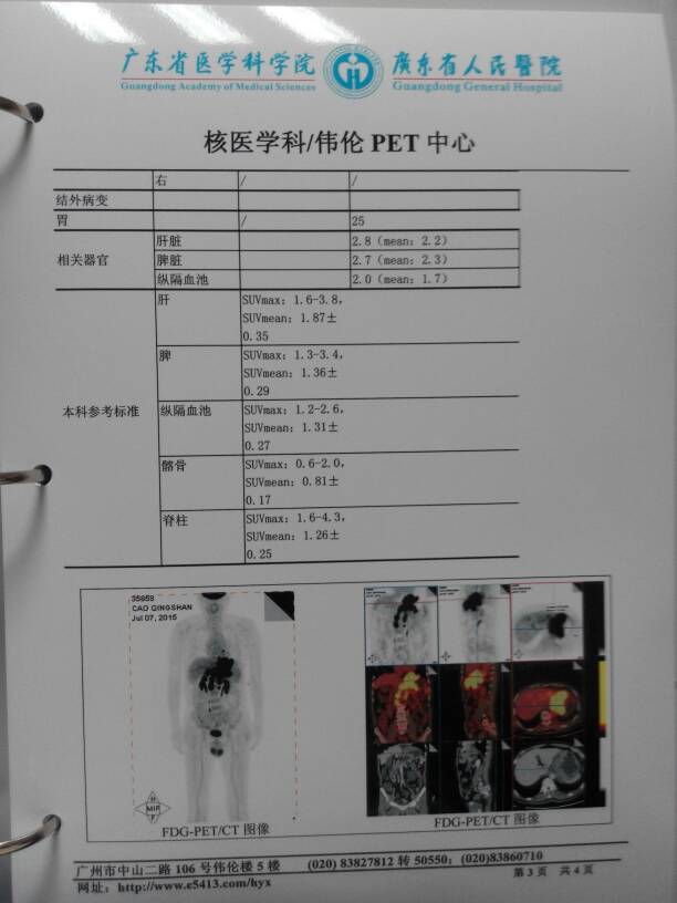 171127gcur03nl7n0qrhhv.jpg