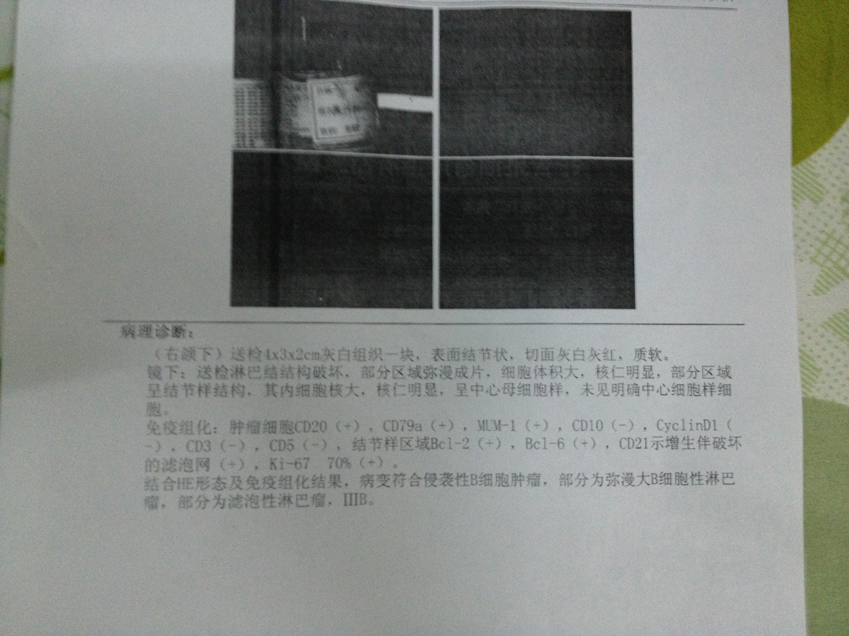 活检病理