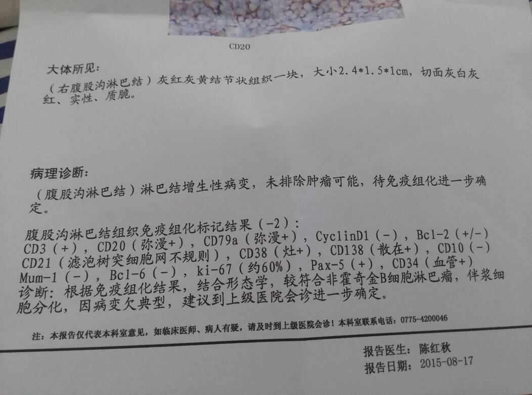 050008lj59avhh8jyrajjm.jpg