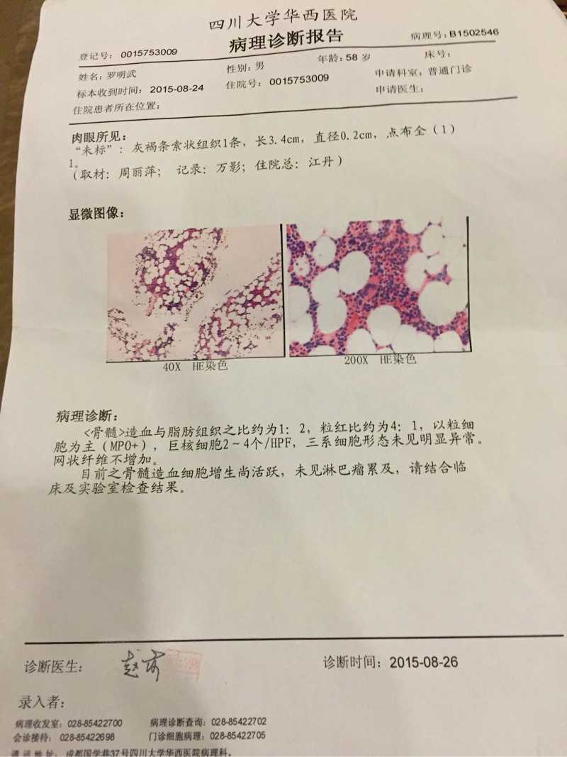 142108ruc9b9d15ek9eeew.jpg