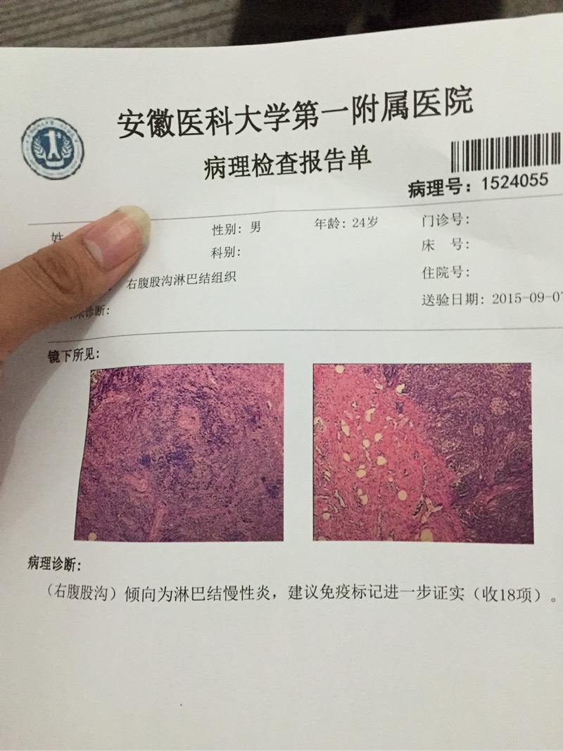 124513s0tb6zz5g8wg6get.jpg