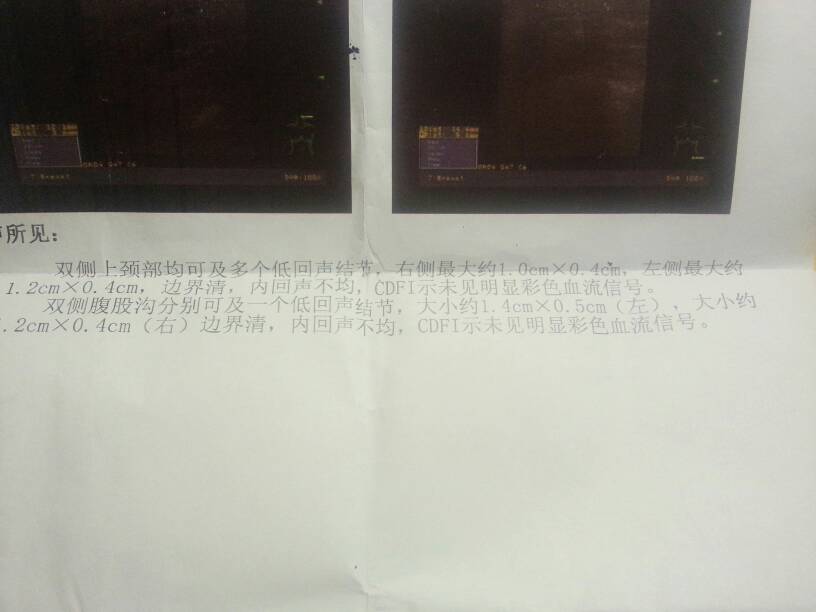 093203mrj00ii0wtj0k1p0.jpg