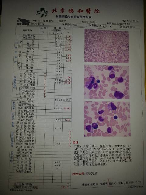 174529ecg1ixci1egxcvb0.png