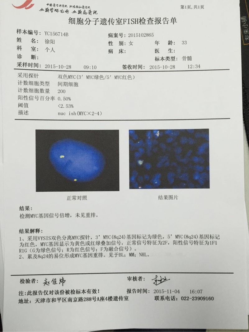 083845xfo1tj3tt1kemumk.jpg