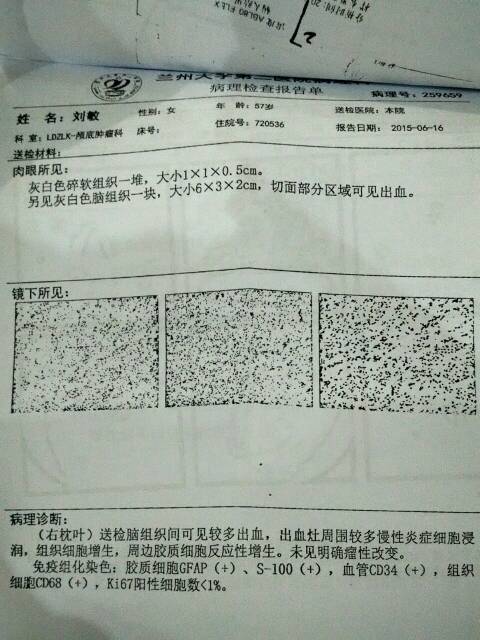 235453ljtj2nx0mh17xmnh.jpg