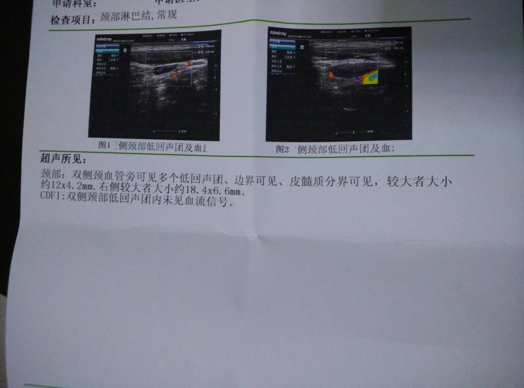 213134oxcmvgqvefnsqbv3.jpg