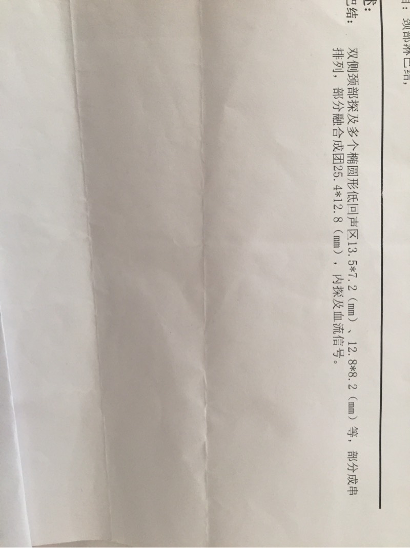 123723aardemmj0jcrr2fd.jpg