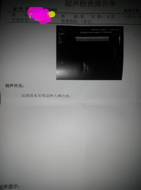 143530e7q2cc2cgc2c4tt0.jpg