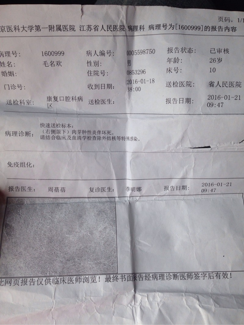 125813u1m501pi34p4iir3.jpg