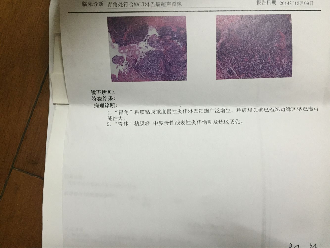 2014年12月第二次超声胃镜病理.jpg