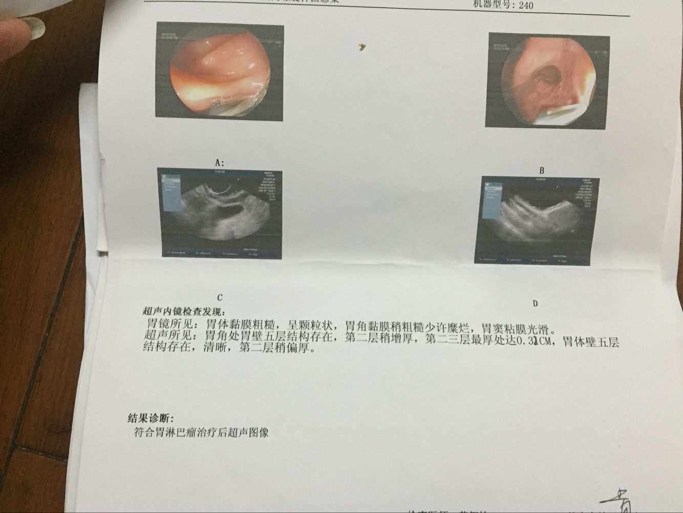 2015年6月第三次超声胃镜.jpg