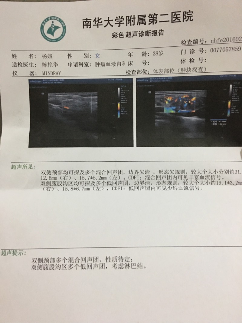 164203l038yc8eyyje778a.jpg