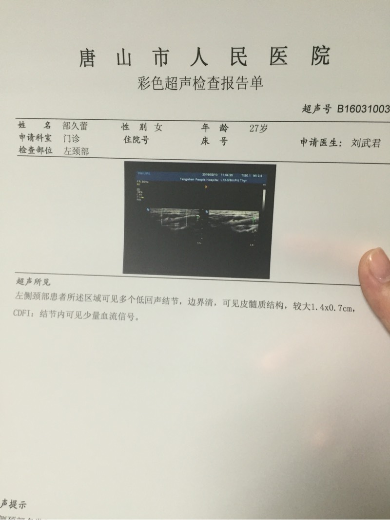 223625nizs3ocbssk3wpsg.jpg