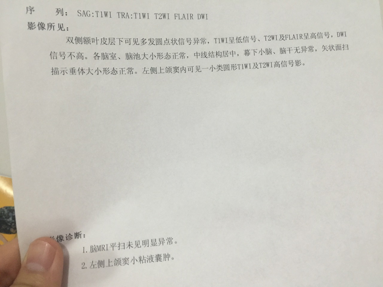 左侧上颌窦小粘液囊肿