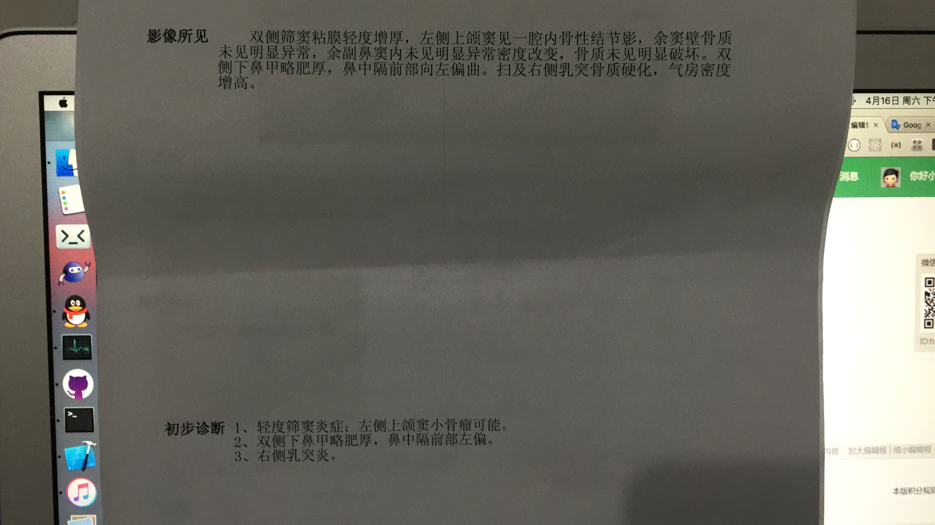  副鼻窦CT平扫+3D20160416