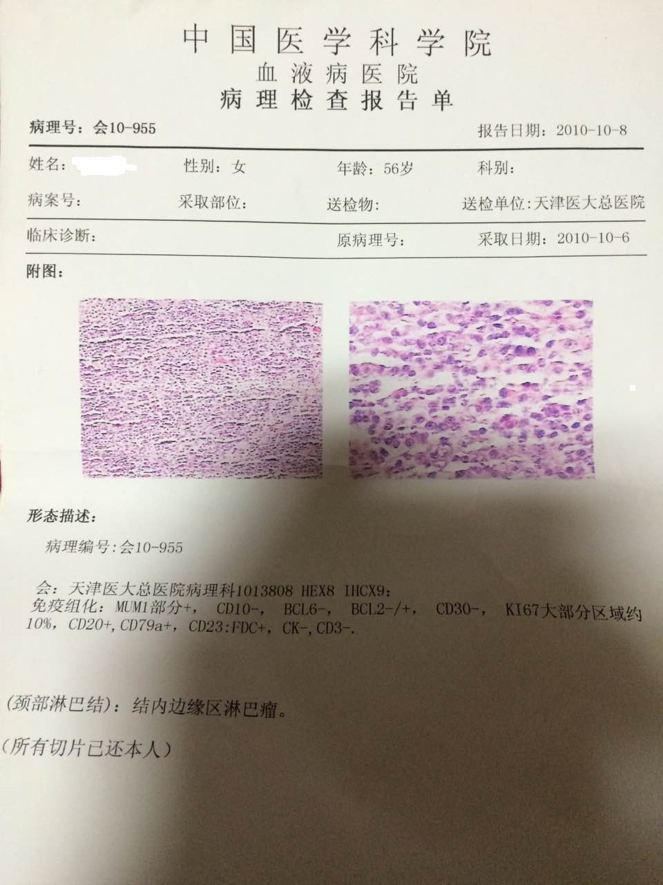 天津血研所病理.JPG