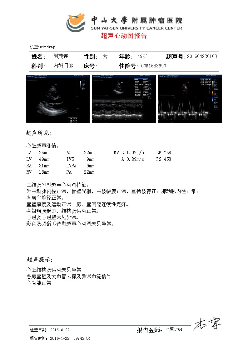心脏彩超.JPG