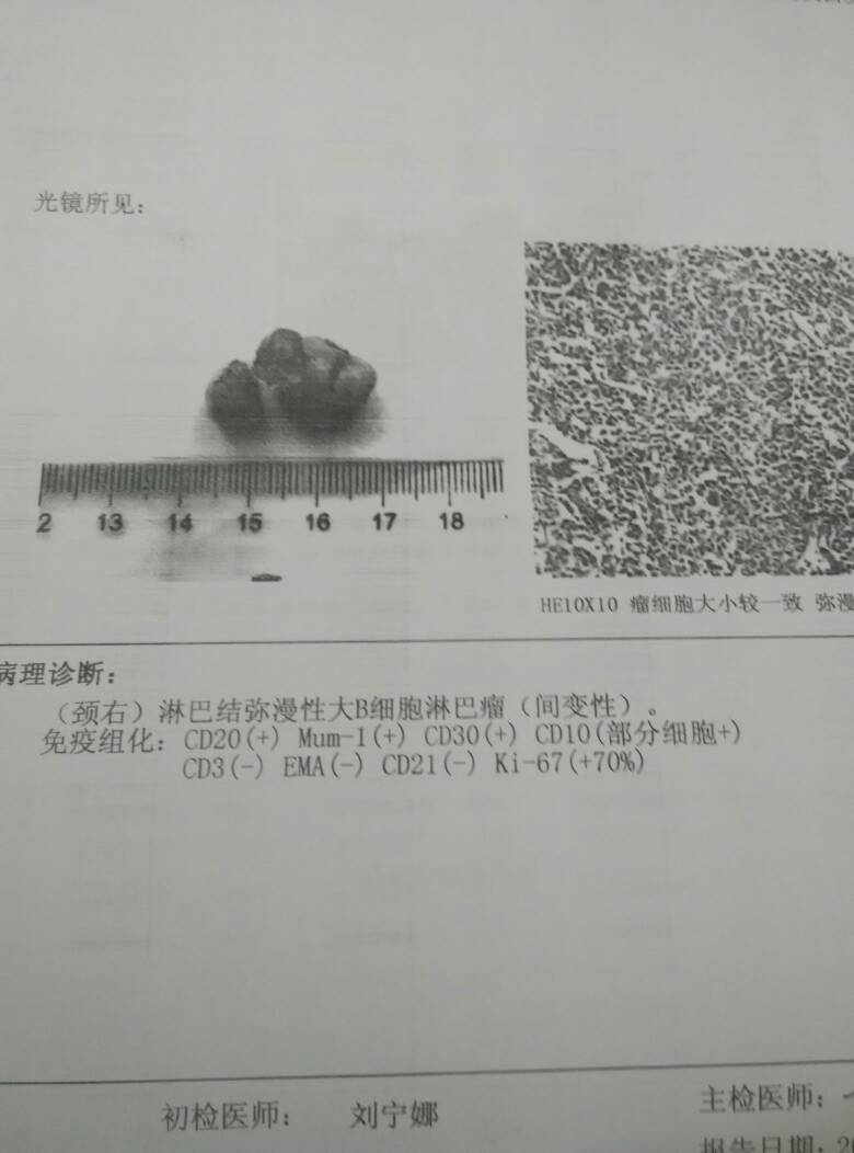 103815ofzdh4kpxpxyxhf5.jpg