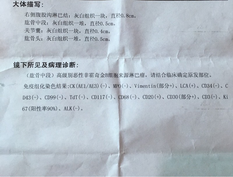 095744nlkt7sk7ann04a5t.jpg
