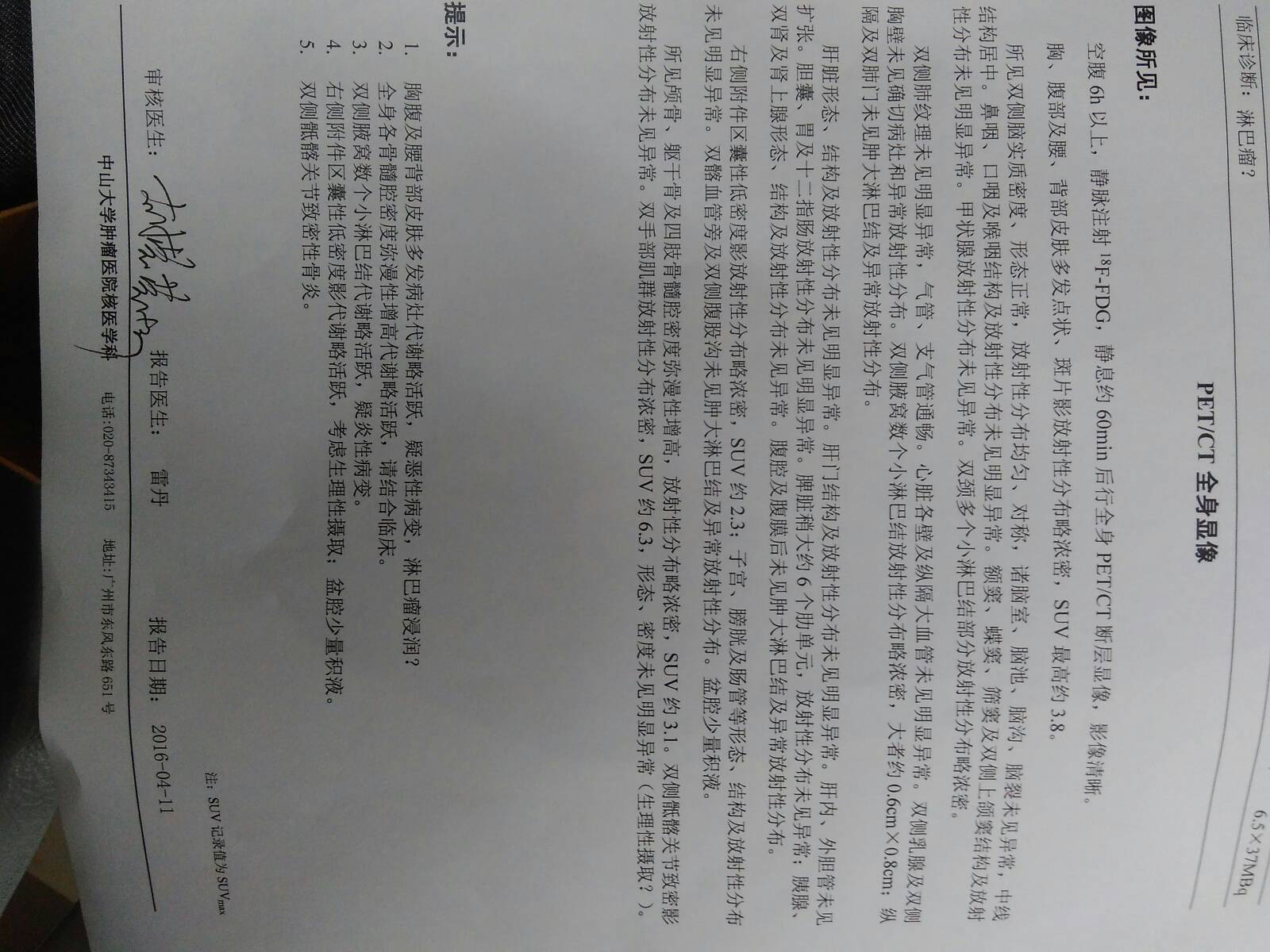 114137uom673gl3d3k7xoo.jpg