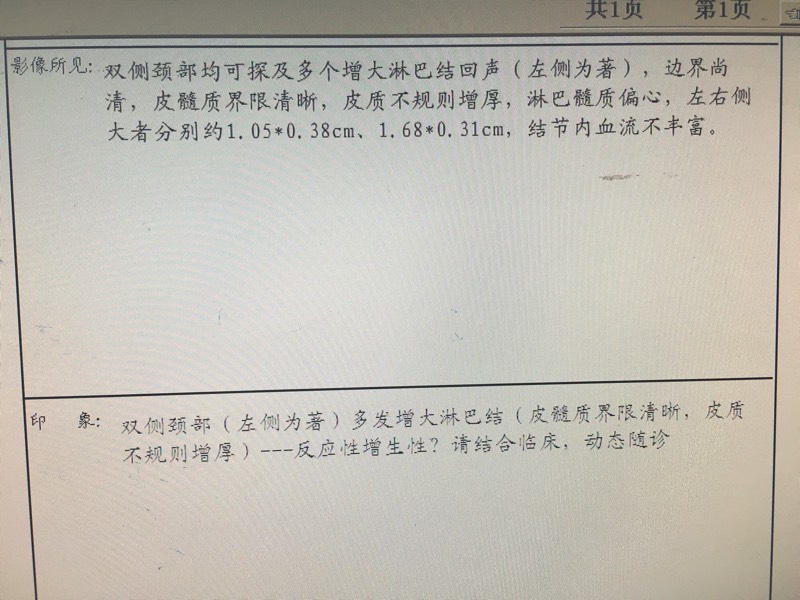 164622r7e7dlpqx3nvgpes.jpg