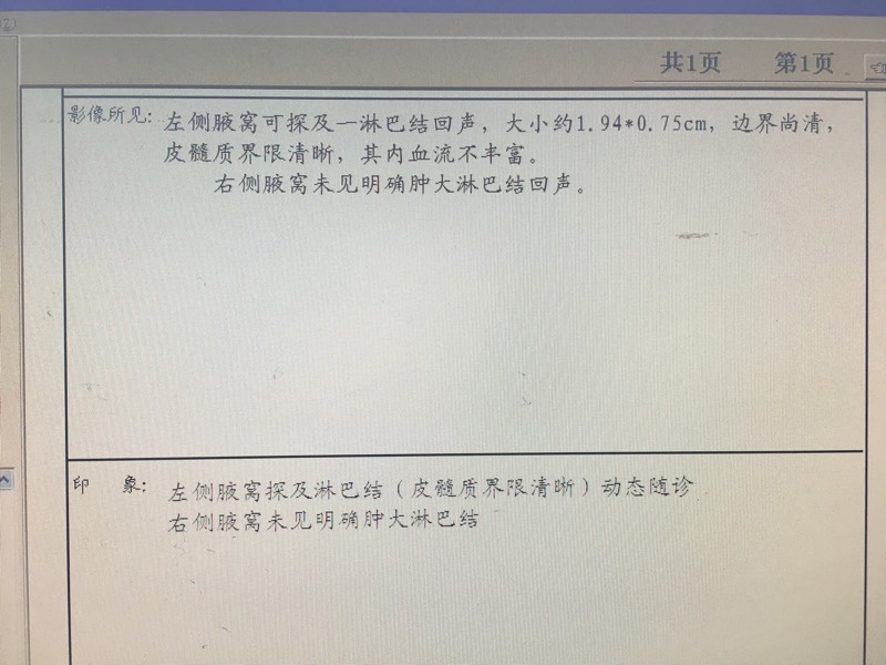 164624x84i01wuq00w8k47.jpg
