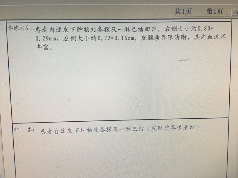 164628dwd3rzdi7xz6rqi1.jpg