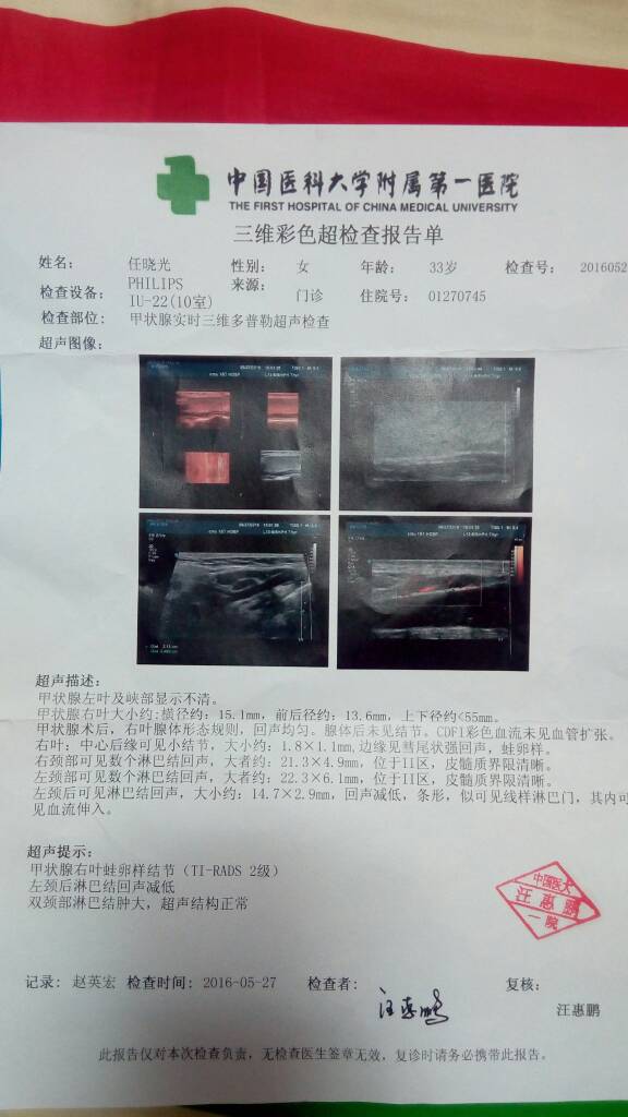 071737aecpd7zwb61sc7ze.jpg