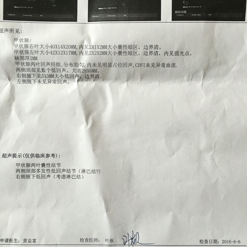 080652yjsc6mskm7y1zsh2.jpg