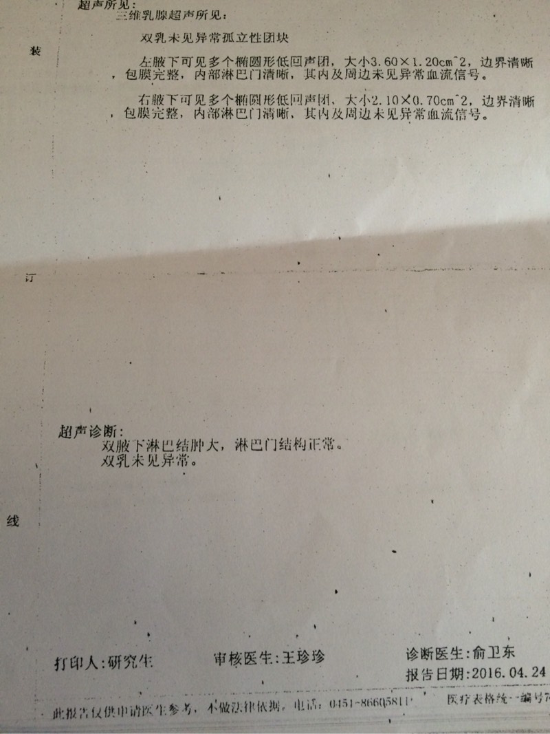 140458s2yjg20cpt7jboqx.jpg