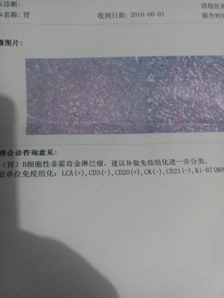 081244dczvqc92qhpqpyff.jpg