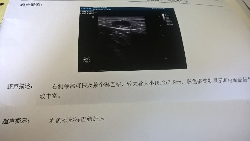 超声