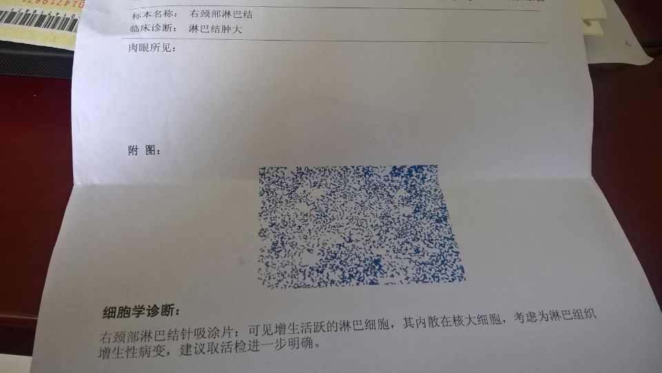 穿刺