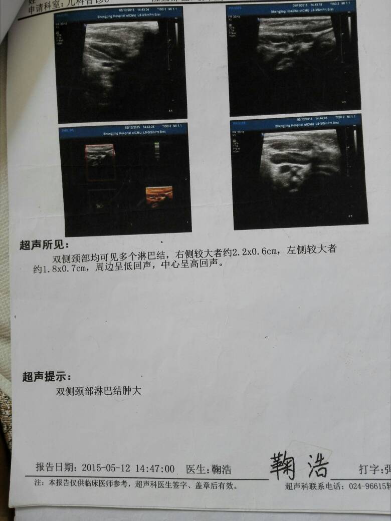 140125z2ps9chclshxpzal.jpg