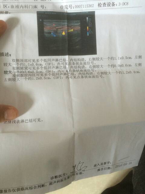 202758lmz4xe4uq54zgp4q.jpg