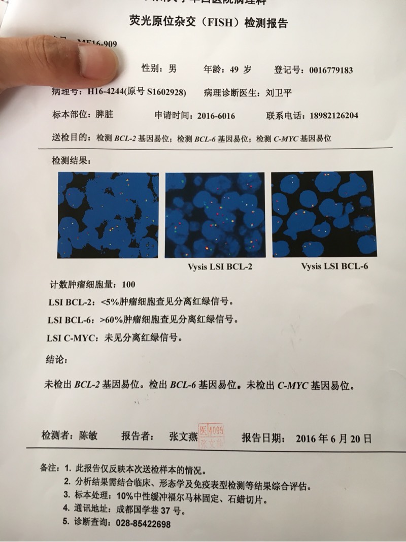 114213x1w5i1y15yoo55yi.jpg