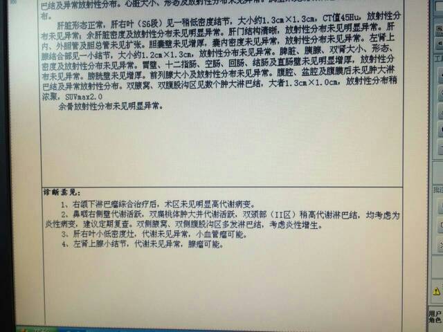 175427hw8qw66nqanw8awq.jpg