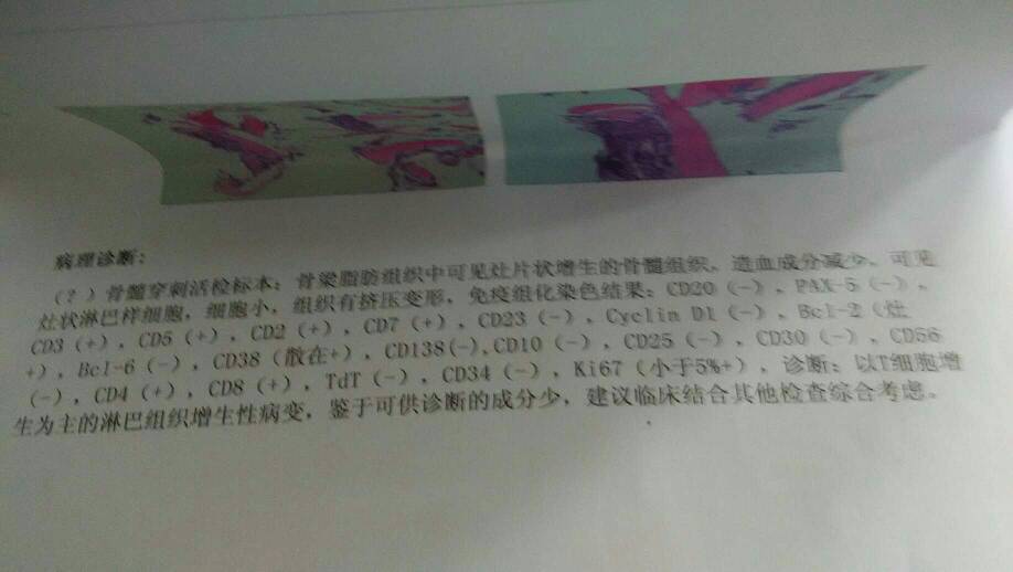 231531cddssx95z5xtss1i.jpg
