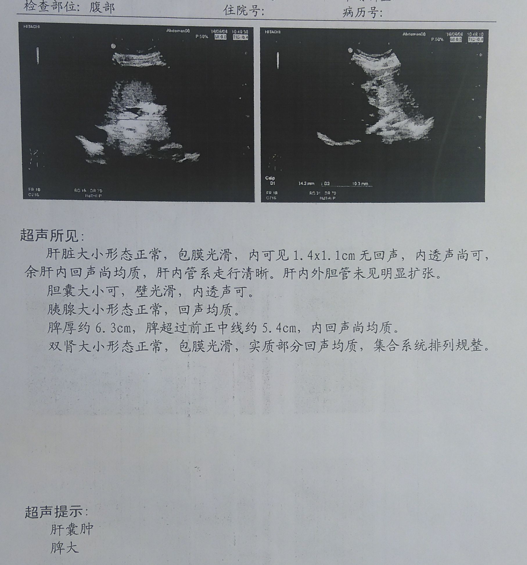 组化