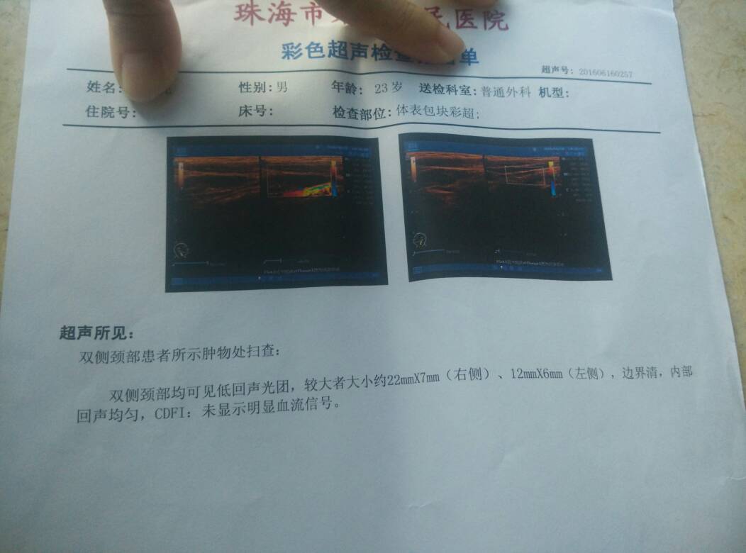 204132ip5ajug7ze9a5pga.jpg