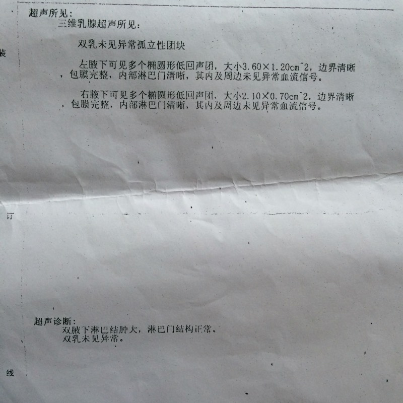 165309dj18j5yh2kuh14o8.jpg