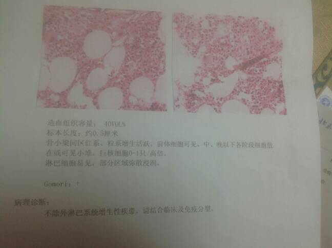 213635h7pcwe7w3m7ttwqk.jpg
