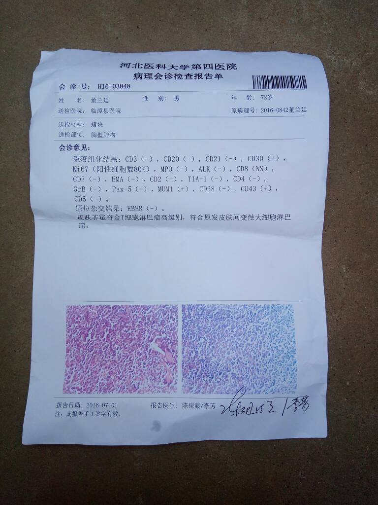 230456ajs4jrs8r90j4u6d.jpg